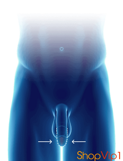 gel titan lô mới